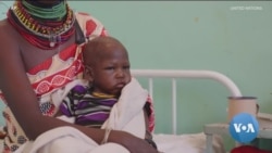 በአፍሪካ ቀንድ የምግብ እጥረት እና ሞት ያጠላባቸው ከ1.9 ሚ. በላይ ሕፃናት መኖራቸውን ዩኒሴፍ አስጠነቀቀ