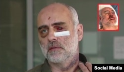 შსს-ს სპეცრაზმის მიერ გატაცებული და სასტიკად ნაცემი აქტივისტი დავით ქაცარავა