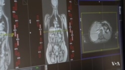 သကြားရဲ့ အန္တရာယ် ချိုချို 
