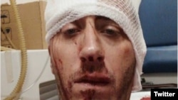 Vladimir Kovačević nakon napada