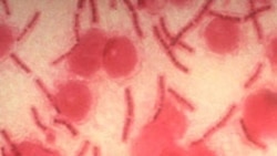 Bakteria aina ya Kimeta yaani Anthrax 