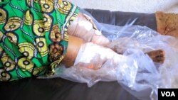 Mmoja wa majeruhi wa shambulizi la kigaidi lililotokea katika kanisa moja mjini Kasindi, wilaya ya Beni, DRC.