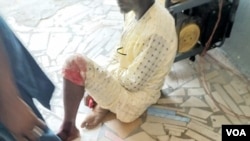 Wasu mutane da su ka raunata