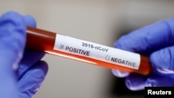 ILUSTRACIJA - Epruveta sa testom na koronavirus (Foto: Reuters/Dado Ruvić)