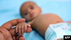 FILE - A woman holds the hand of a Yemeni child suffering from malnutrition as he lies in a bed at a treatment center in the country's third-city of Taez, Oct. 28, 2020.