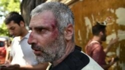 სასტიკად ნაცემი ფოტოკორესპოდენტი