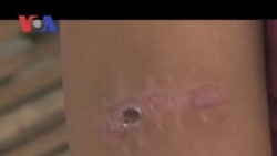 Shooting Victims in Fear as Alleged Shooter Goes Free (Cambodia news in Khmer)