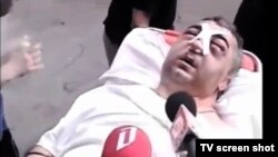 დეპუტატი გელაშვილი სოდ-ის სპეცრაზმის თავდასხმის შემდეგ. თბილისი. 2005 წლის 14 ივლისი