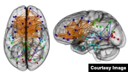 ქალის თავის ტვინი