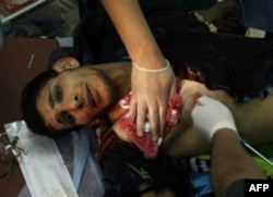 Qaddafiy kuchlari muxolifatni havodan urdi, mamlakat fuqaro urushiga tortilmoqda