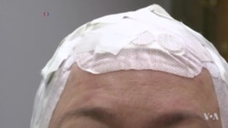 Wearable Electrodes Help Fight Brain Cancer