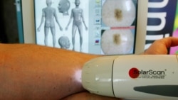 ئامێری سۆلارسکان شێرپەنجەی پێست دەستنیشان دەکات