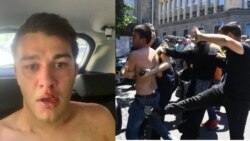 "ფორმულას" ჟურნალისტის რატი წვერავას ცემა - ამ დრომდე არცერთი მოძალადე დაკავებული არ არის