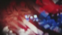 هېلو وي او اې په ټي وي