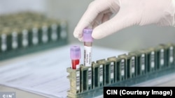 Trgovci medicinskom opremom poklonili su bolnicama opremu vrijednu 2,2 miliona KM kako bi došli do milionskih tendera za nabavku reagensa. 