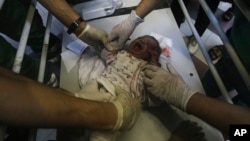 Палестинските здравствени власти во Газа известуваат за десетици смртни случаи во опколената болница Ал Шифа – Шефот на СЗО вели дека најголемата болница во Газа повеќе не функционира