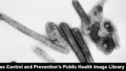 شکل ویروس ماربرگ در زیر مایکروسکوپ